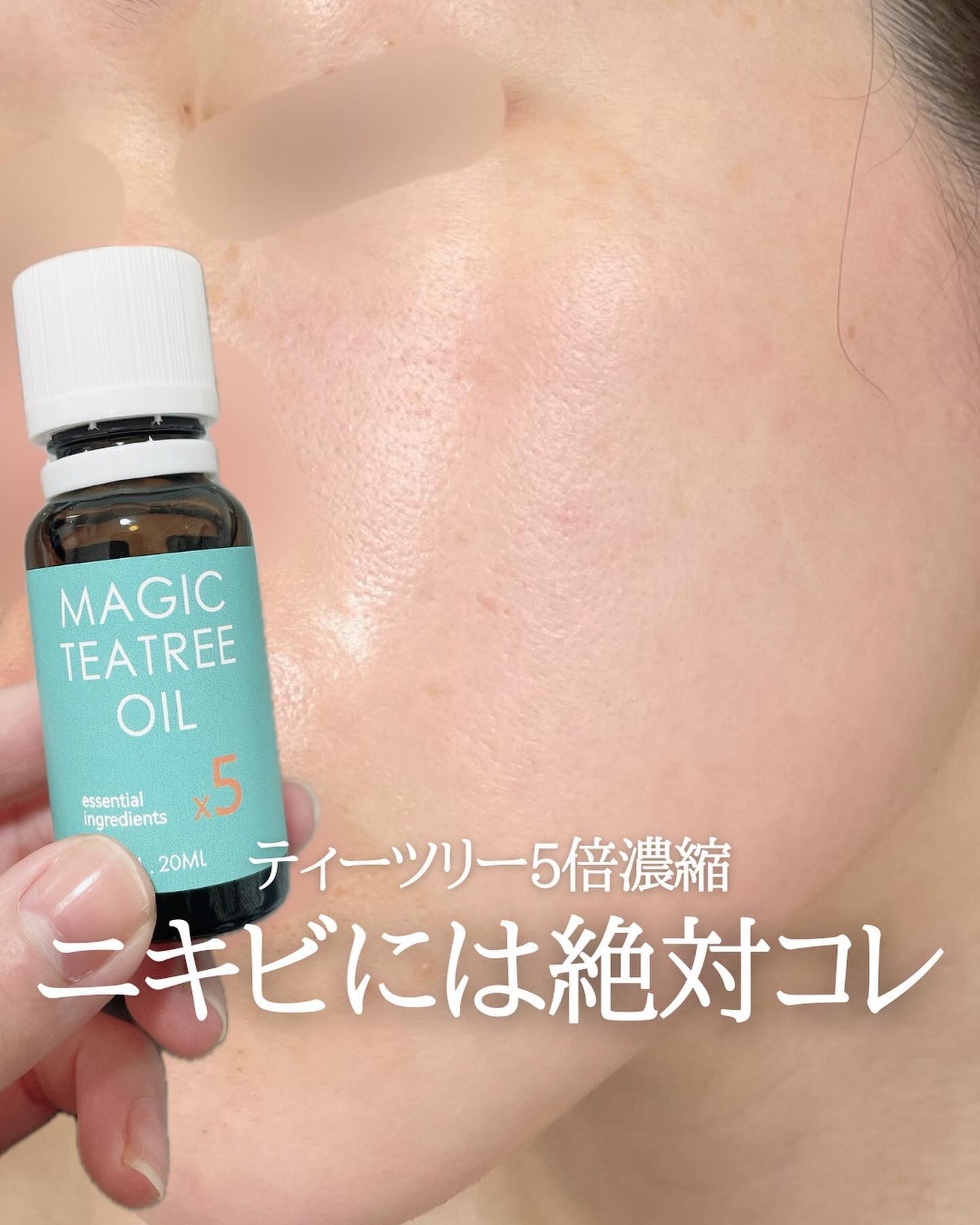 マジックティーツリーオイル/ブラン/フェイスオイルを使ったクチコミ(1枚目)