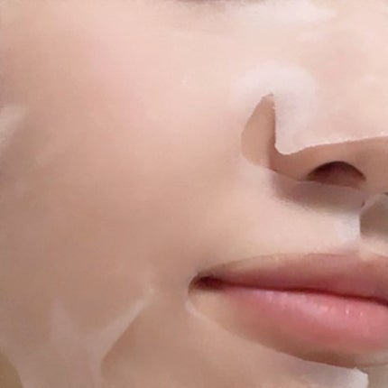 スキントラブルケア マスク/アルージェ/シートマスク・パックを使ったクチコミ(3枚目)