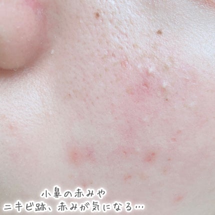 マスク フィット レッド クッション/TIRTIR(ティルティル)/クッションファンデーションを使ったクチコミ(8枚目)