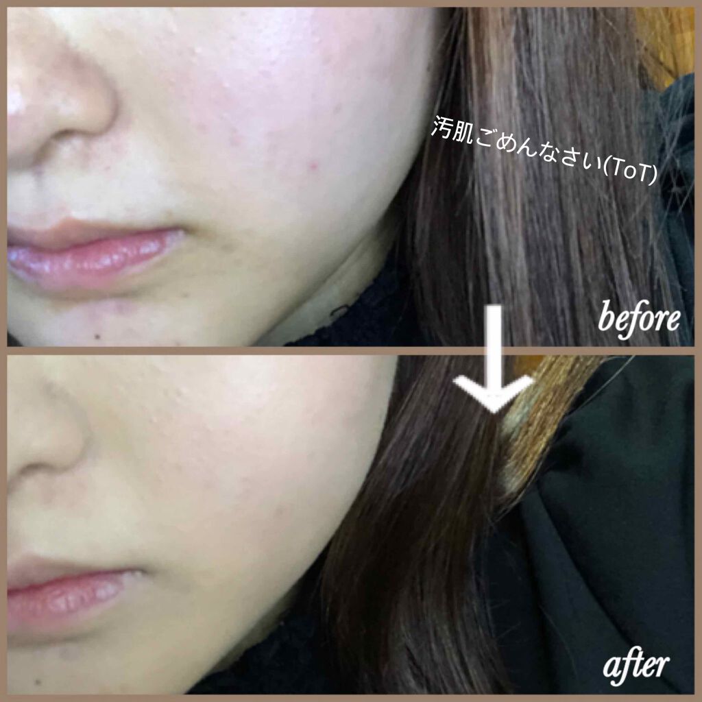 ハイカバーリキッド /クリアラスト/BBクリームを使ったクチコミ(3枚目)