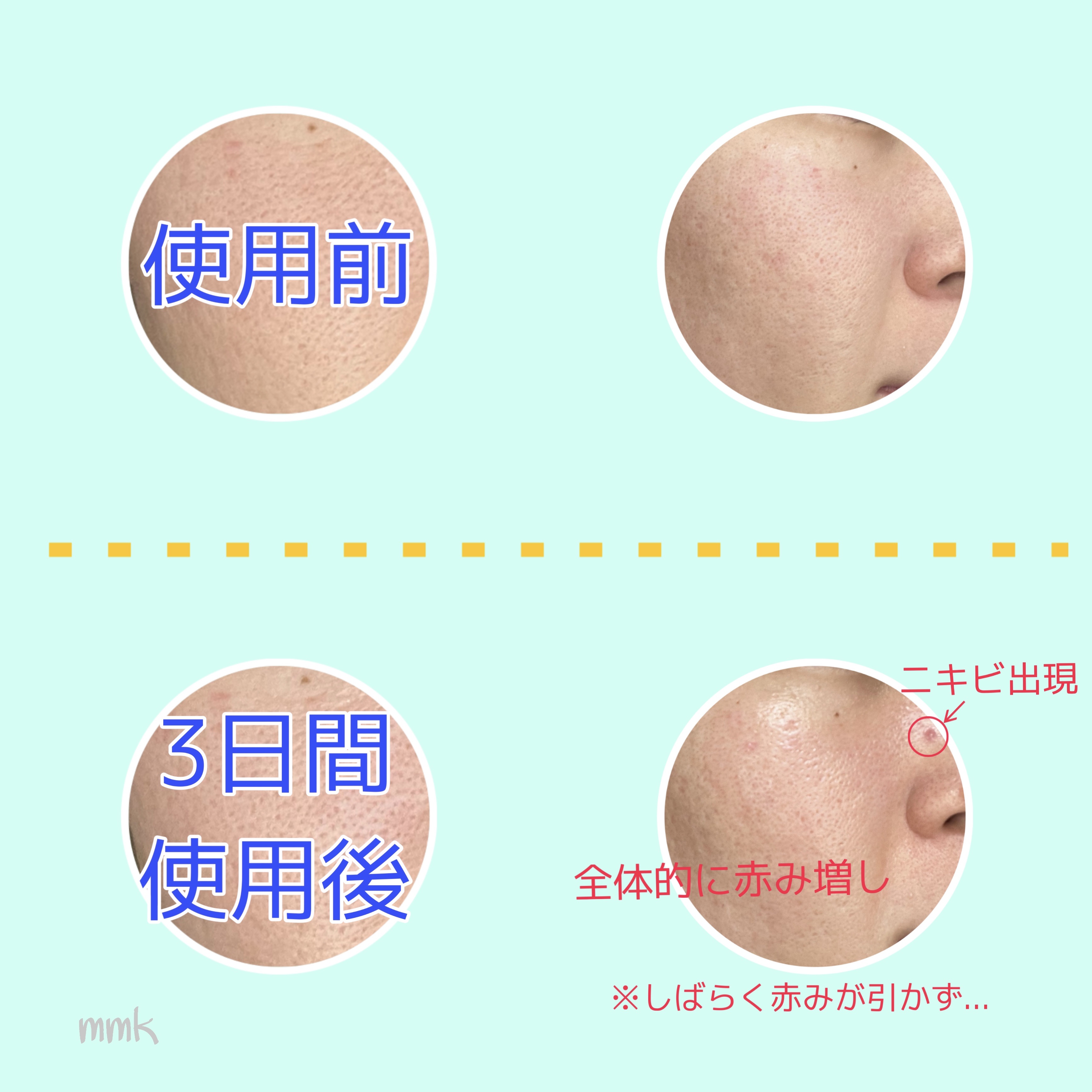 リードルショット100/VT/美容液を使ったクチコミ（3枚目）