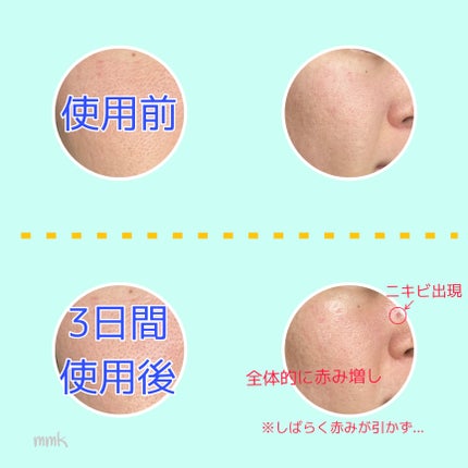 リードルショット100/VT/美容液を使ったクチコミ(3枚目)