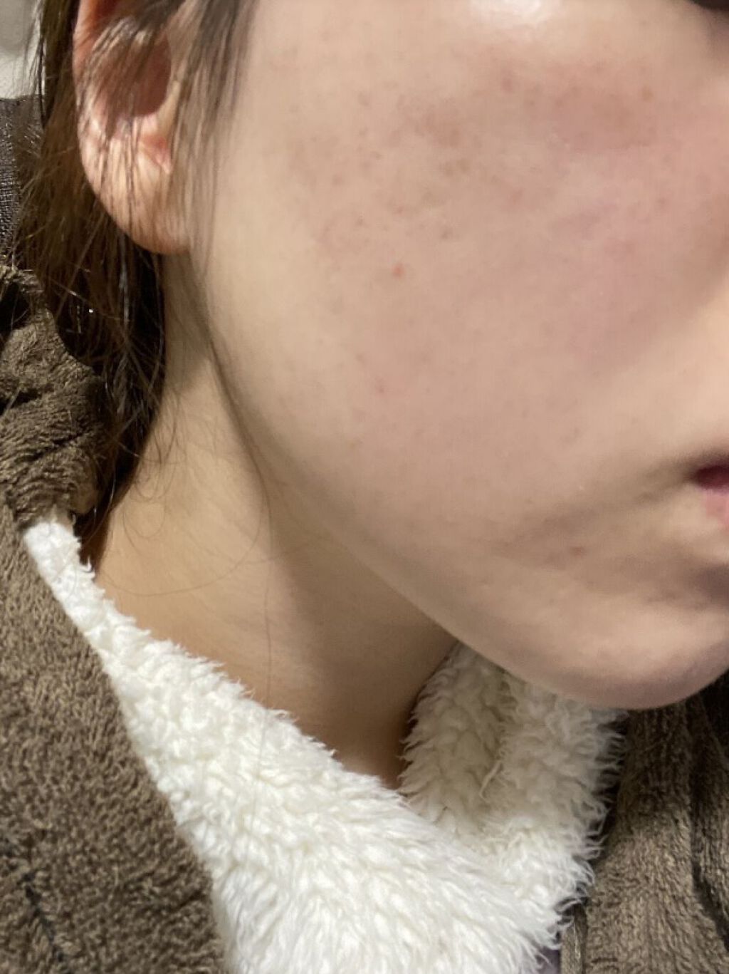 アピットジェル/全薬工業/美容液を使ったクチコミ（1枚目）