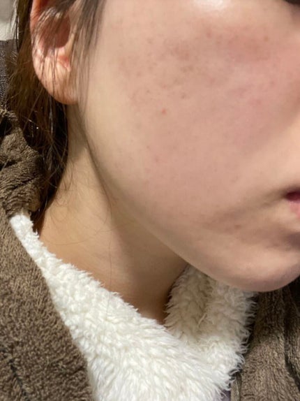 アピットジェル/全薬工業/美容液を使ったクチコミ(1枚目)