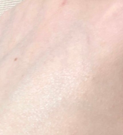 美活肌エキス/ドモホルンリンクル/美容液を使ったクチコミ(4枚目)