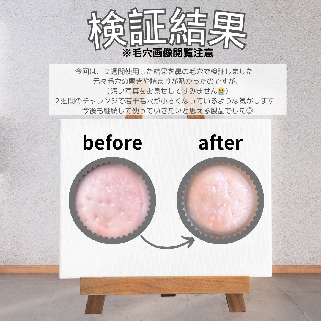 プロCICAリードルショット100/VT/ブースター・導入液を使ったクチコミ(4枚目)