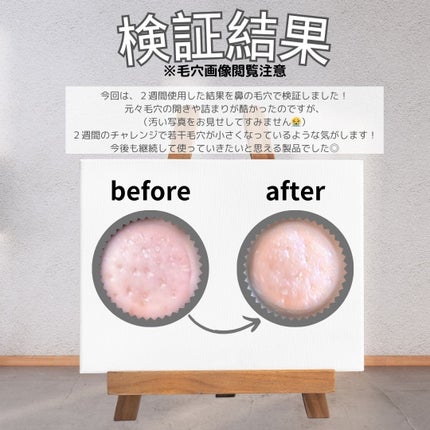 プロCICAリードルショット100/VT/ブースター・導入液を使ったクチコミ(4枚目)