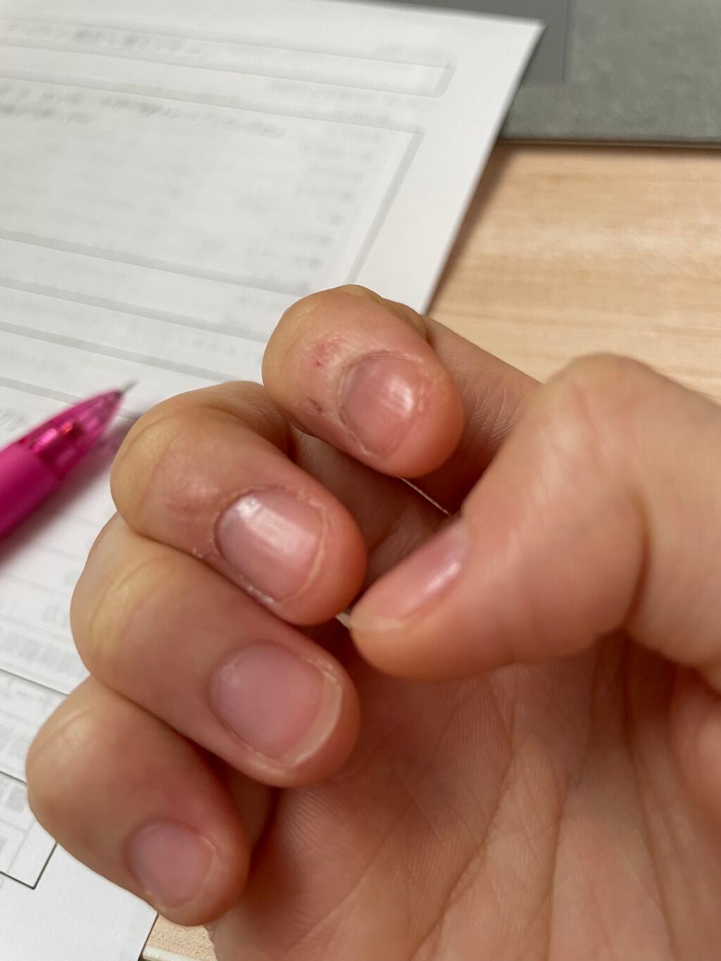 エテュセ クイックケアコート/ettusais/ネイルオイル・トリートメントを使ったクチコミ(3枚目)