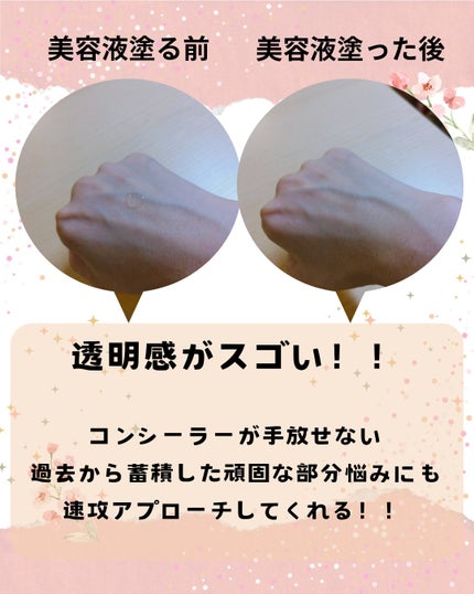 ダーマレーザー スーパー グルタチオン100 マスク/クオリティファースト/シートマスク・パックを使ったクチコミ(5枚目)