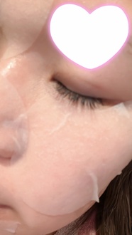 センテラ クイックカーミングパッド/SKIN1004/トナーパッドを使ったクチコミ（3枚目）