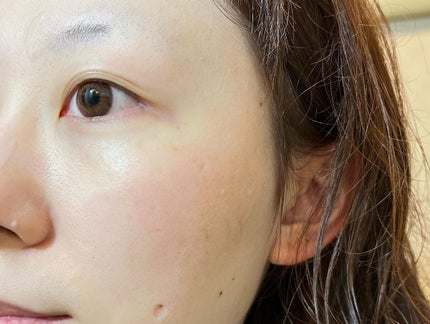 Natsuki on LIPS 「なめこさんジェルクリーム𓏸𓂂𓂂𓂃商品特徴𓂃𓈒𓂂𓏸肌荒..」(5枚目)