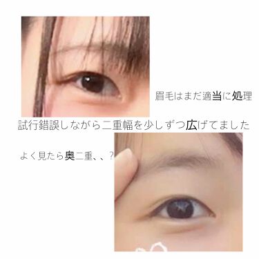 二重になる方法 ダブルアイリキッド Automatic Beautyの使い方や二重メイク 2年半かけて二重になり By Rt 普通肌 Lips