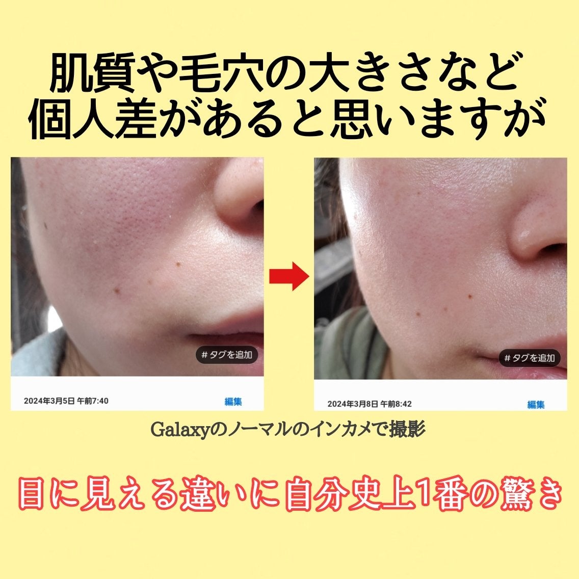 ビタリアルトーニングレーザークリーム/MEDITHERAPY/フェイスクリームを使ったクチコミ(2枚目)