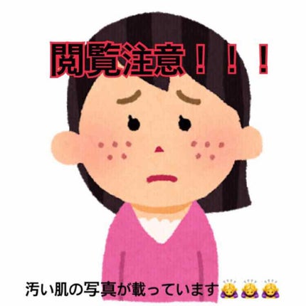 化粧水・敏感肌用・しっとりタイプ/無印良品/化粧水を使ったクチコミ(2枚目)