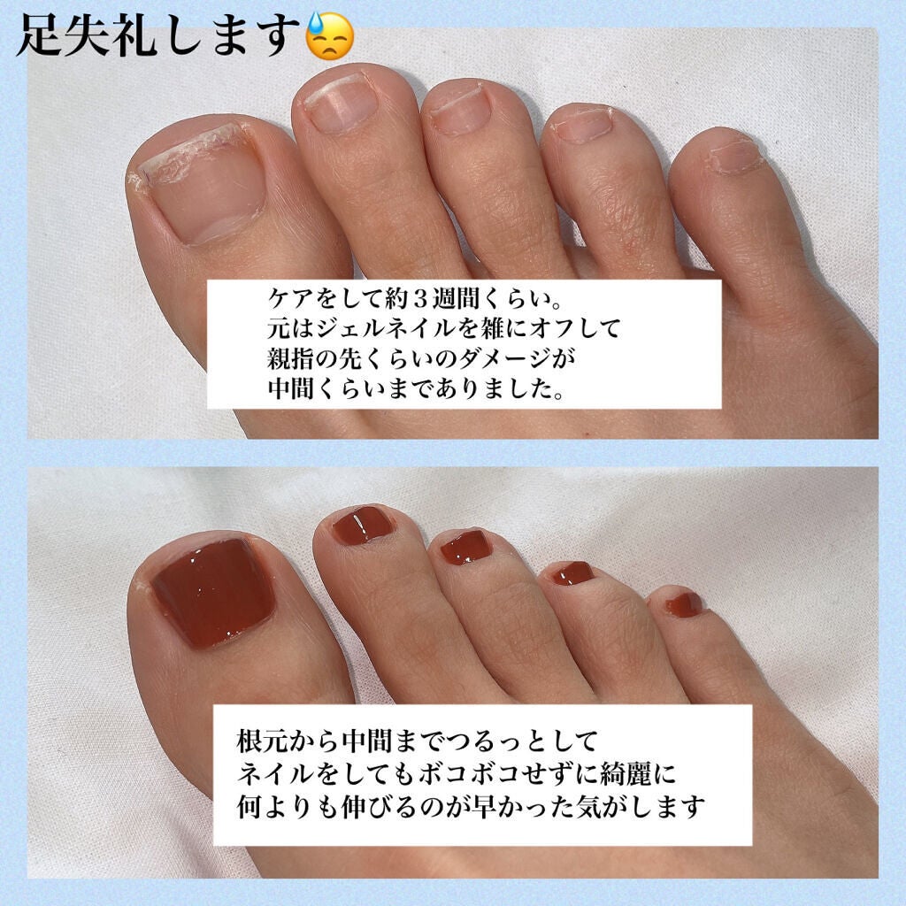 ディープセラム for FOOT/Dr.Nail/ネイルオイル・トリートメントを使ったクチコミ(6枚目)