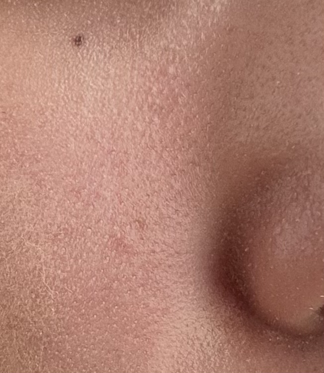 RMK Wトリートメントオイル/RMK/ブースター・導入液を使ったクチコミ（2枚目）