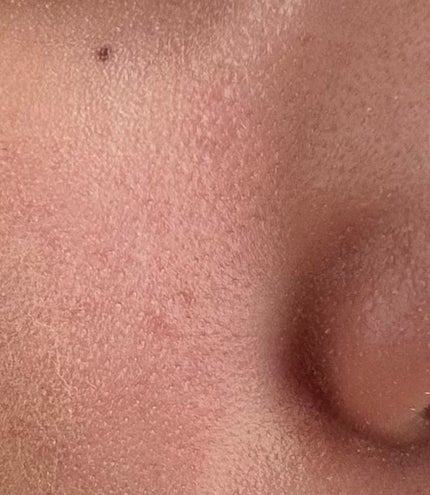 RMK Wトリートメントオイル/RMK/ブースター・導入液を使ったクチコミ(2枚目)