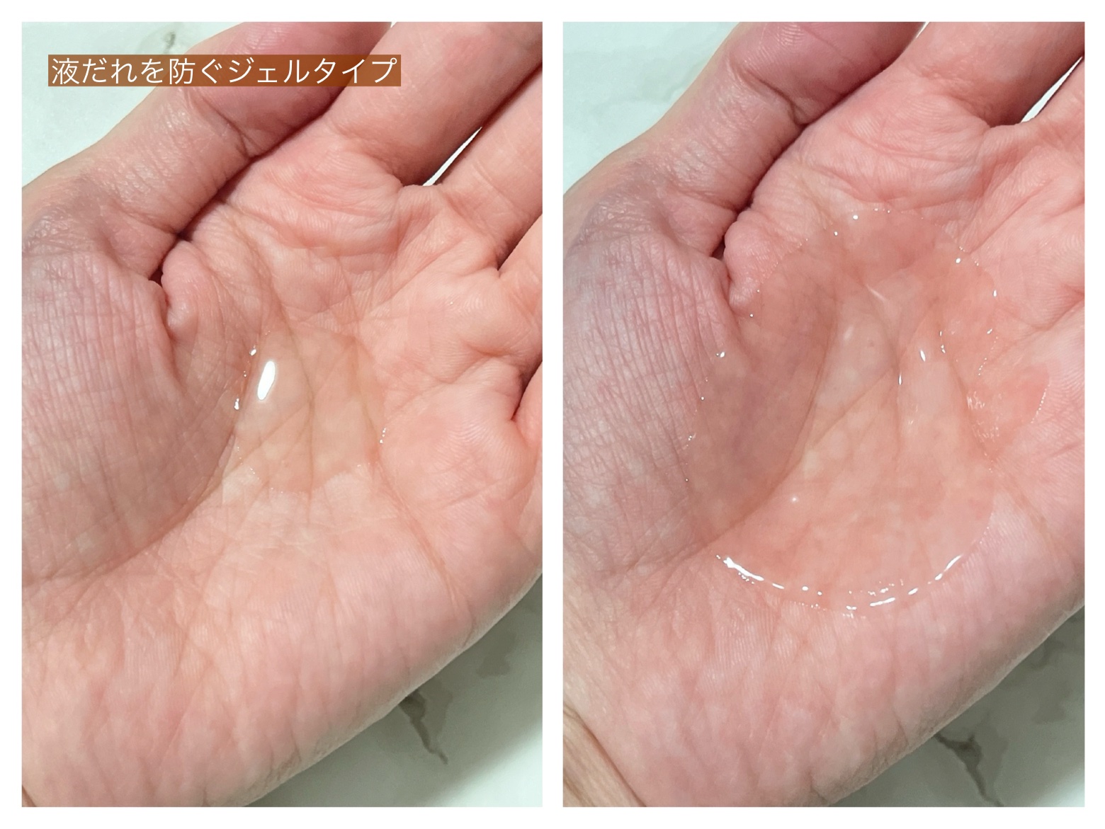 ナノグロウリッチ/iqumore/頭皮ローションを使ったクチコミ（3枚目）