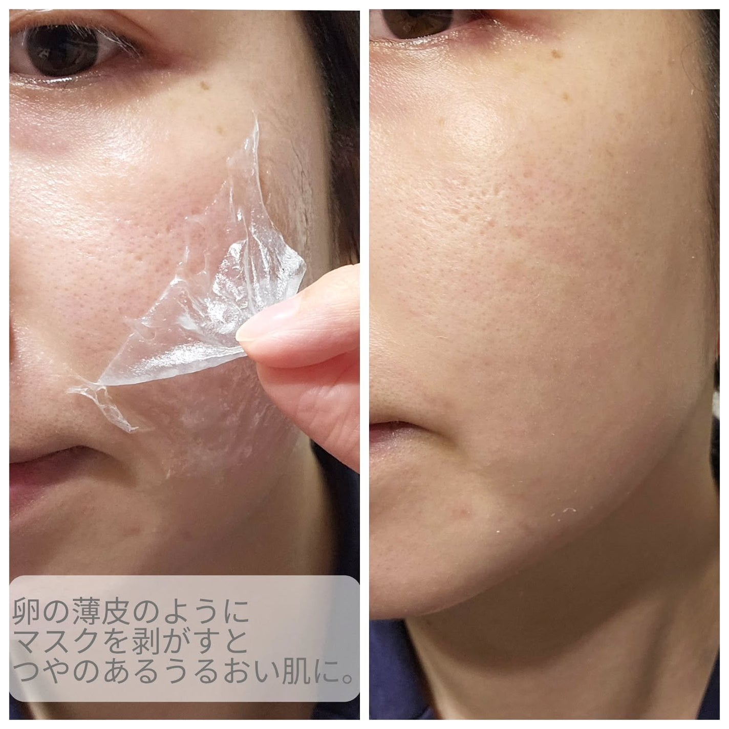 ピートピーディーアールエヌ ラッピングショット フィールオフマスク/One-day's you/シートマスク・パックを使ったクチコミ(4枚目)