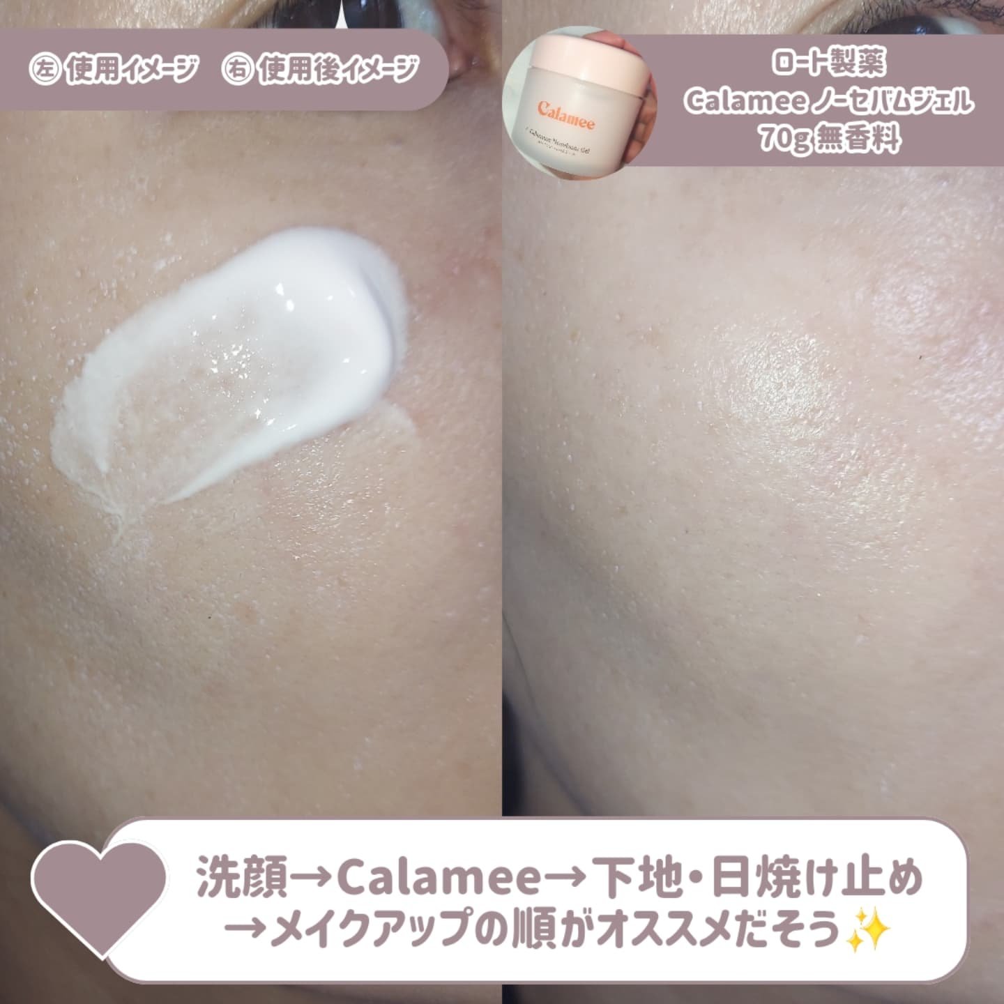 カラミー カラミンノーセバムジェル/Calamee/フェイスクリームを使ったクチコミ（3枚目）