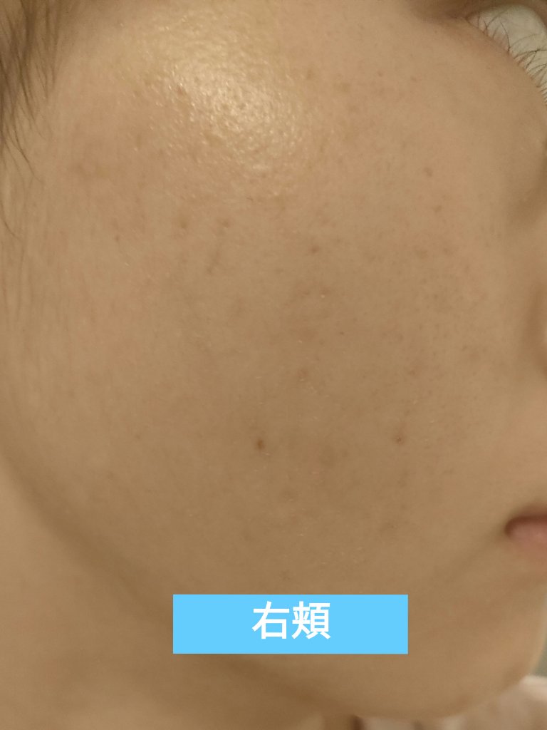 UVシールドEX/NOV/日焼け止めクリームを使ったクチコミ（2枚目）