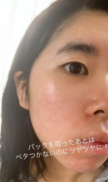 肌美精 CHOIマスク 薬用乾燥肌あれケア/肌美精/シートマスク・パックを使ったクチコミ(4枚目)