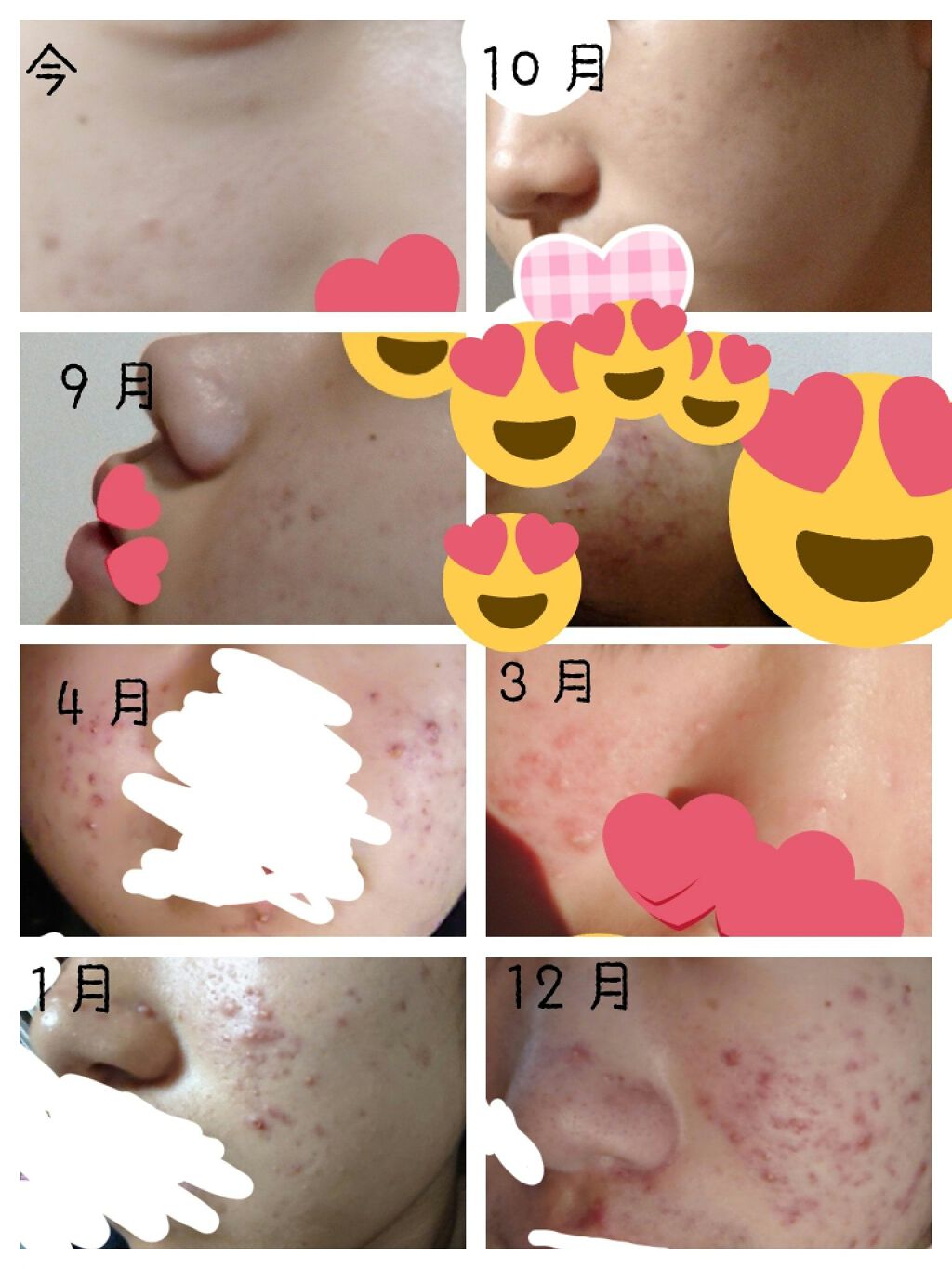 DHC マルチビタミン/DHC/美容サプリメントを使ったクチコミ(2枚目)