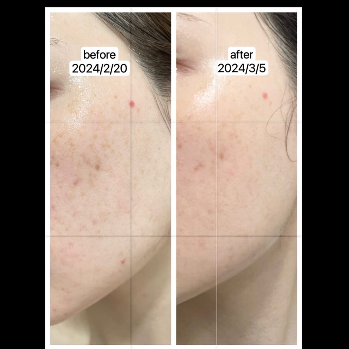 5番 白玉グルタチオンC美容液/numbuzin/美容液を使ったクチコミ(3枚目)