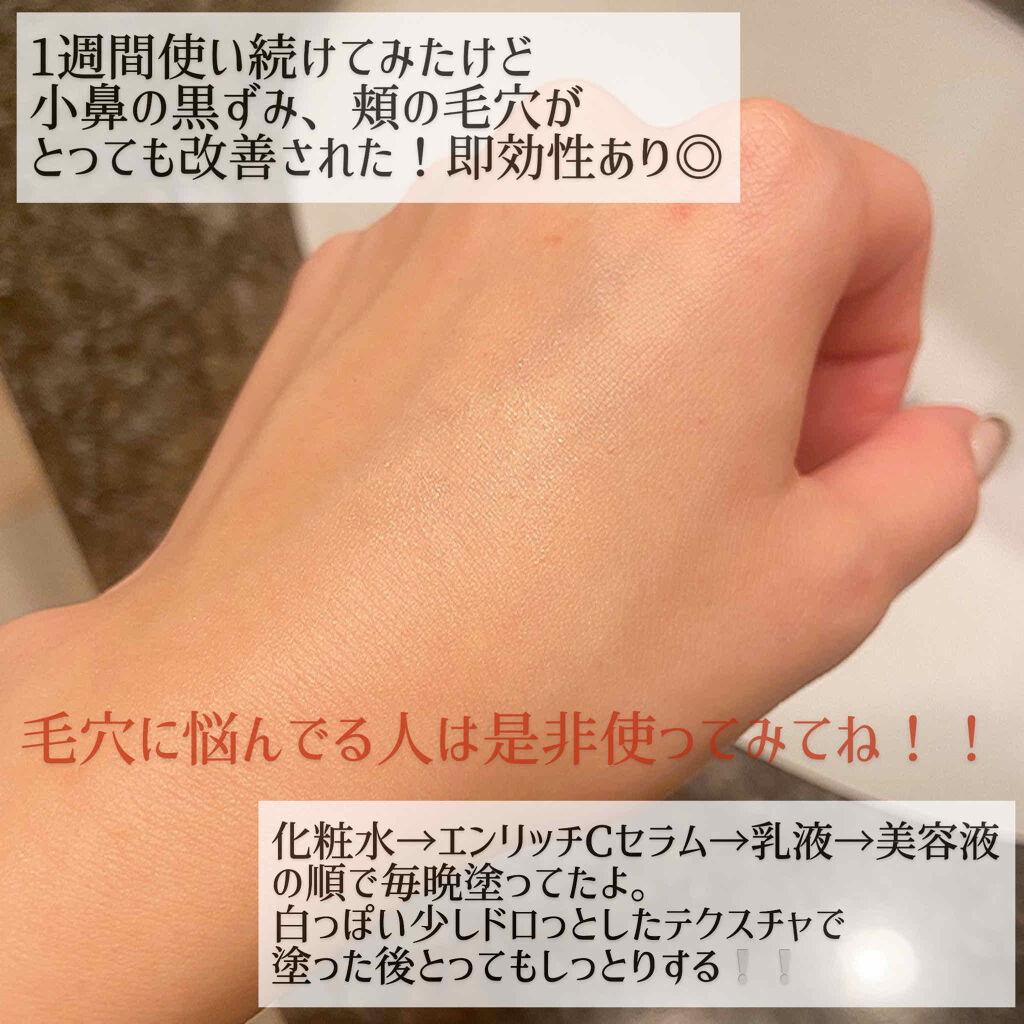 エンリッチCセラム/IGA LAB/美容液を使ったクチコミ（3枚目）