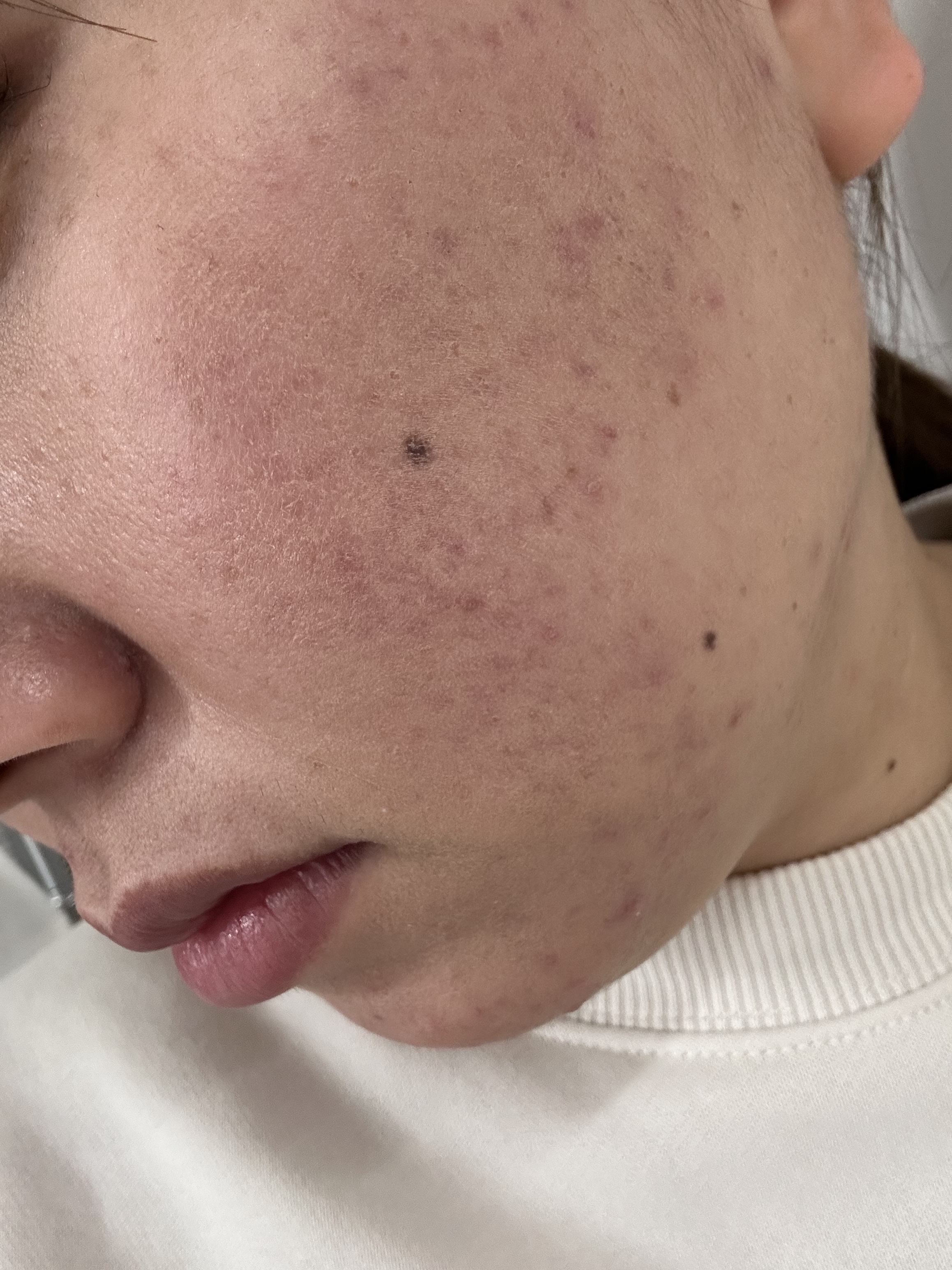 ミシャ グロウ スキンバーム（Ｒ）/MISSHA/化粧下地を使ったクチコミ（2枚目）