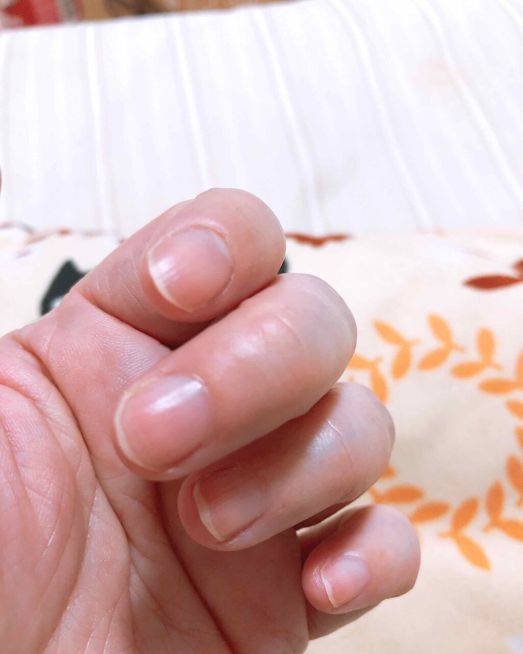 華 on LIPS 「2枚目、使用前3枚目、使用後なんだけど……撮った環境が違いすぎ..」(2枚目)