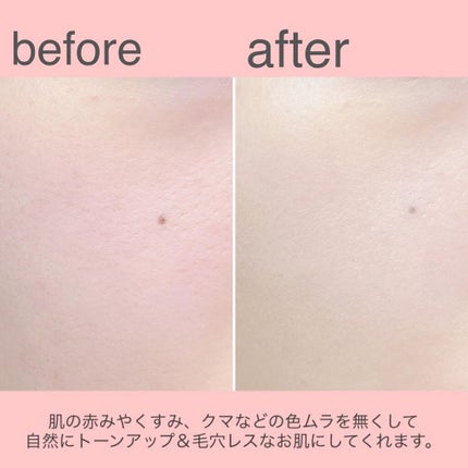 ☺︎︎NIKO☺︎︎【フォロバ100%】 on LIPS 「アスタリュクスモデルを務めさせて頂いている@koseprofe..」(7枚目)