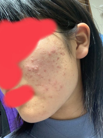 を使ったクチコミ(2枚目)