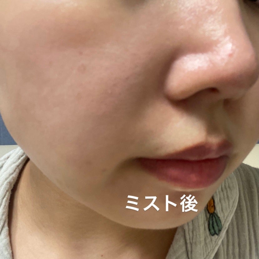 フェイシャルブースティングスパ/Makeon/美顔器・マッサージを使ったクチコミ(7枚目)