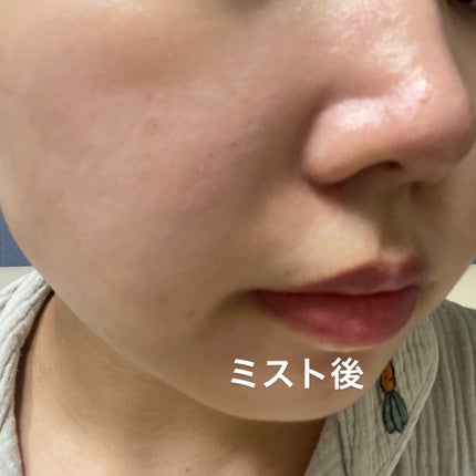 フェイシャルブースティングスパ/Makeon/美顔器・マッサージを使ったクチコミ(7枚目)