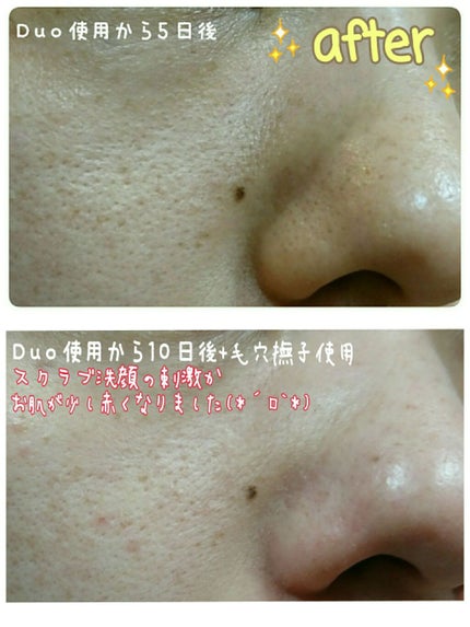 デュオ ザ クレンジングバーム クリア/DUO/クレンジングバームを使ったクチコミ(3枚目)