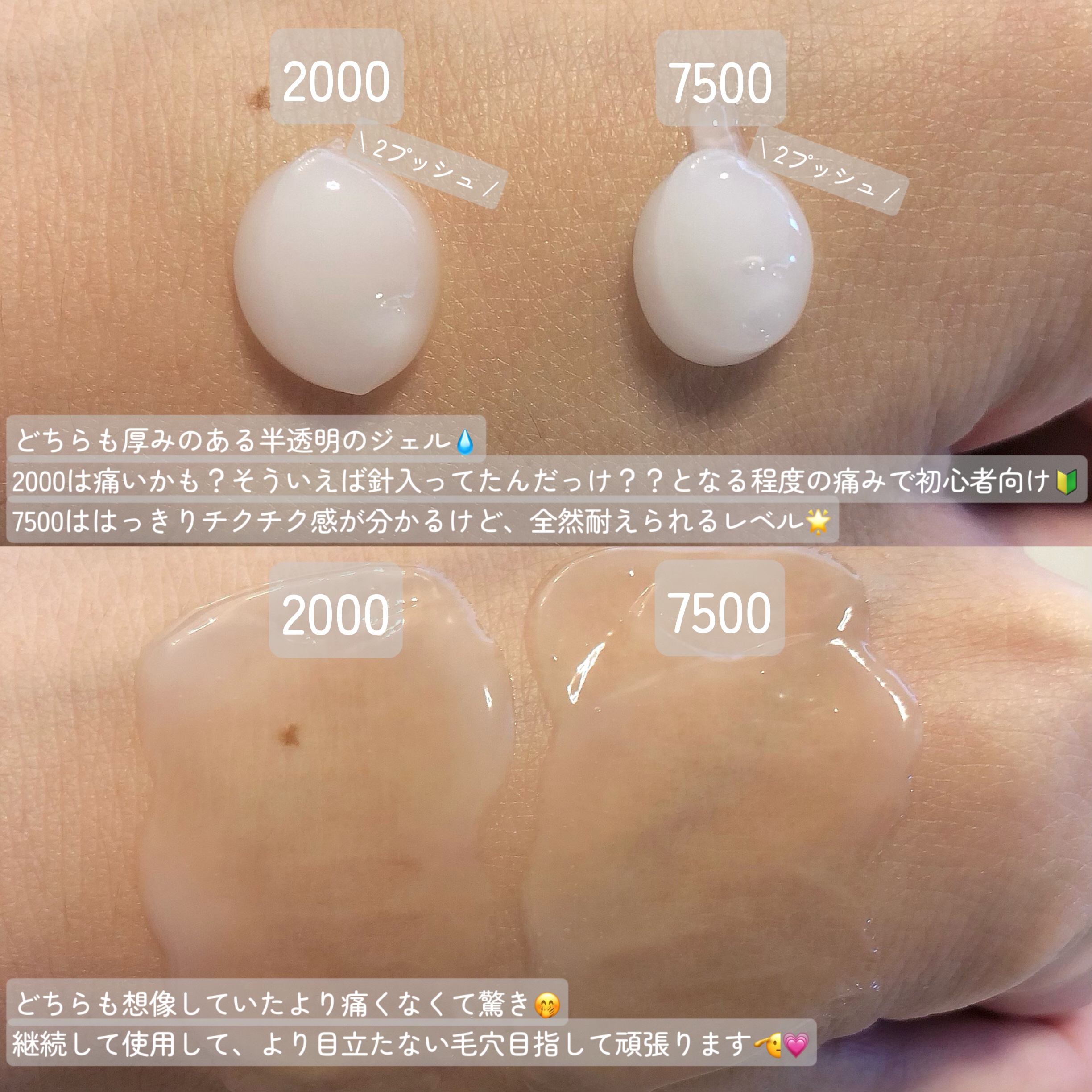 ゼロ1DAYエクソソームショット2000/MEDICUBE/美容液を使ったクチコミ（3枚目）