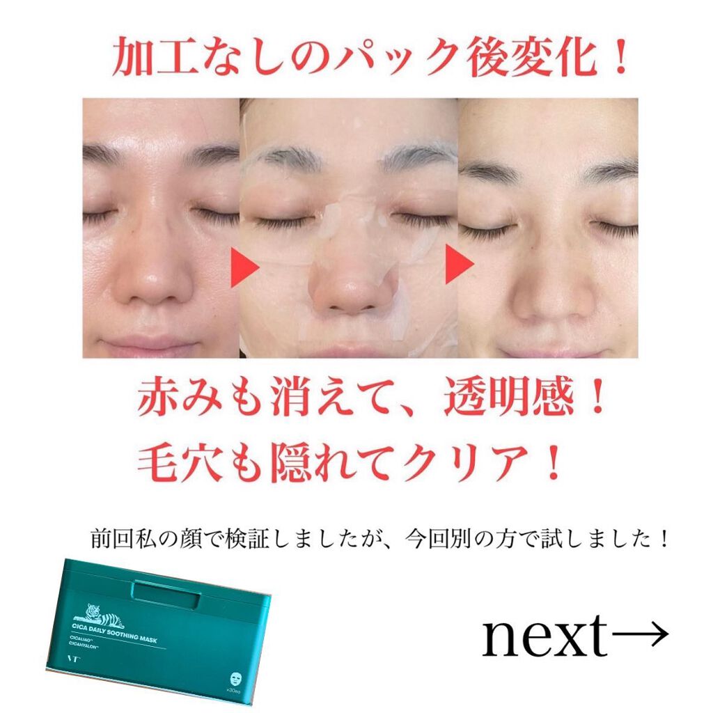 CICA デイリースージングマスク/VT/シートマスク・パックを使ったクチコミ（2枚目）