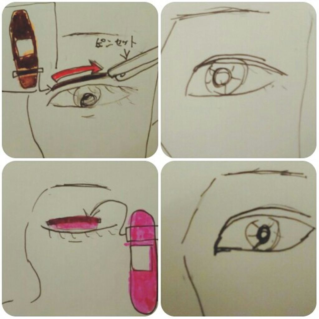 肌色タイプ/バンドエイド/その他を使ったクチコミ(2枚目)