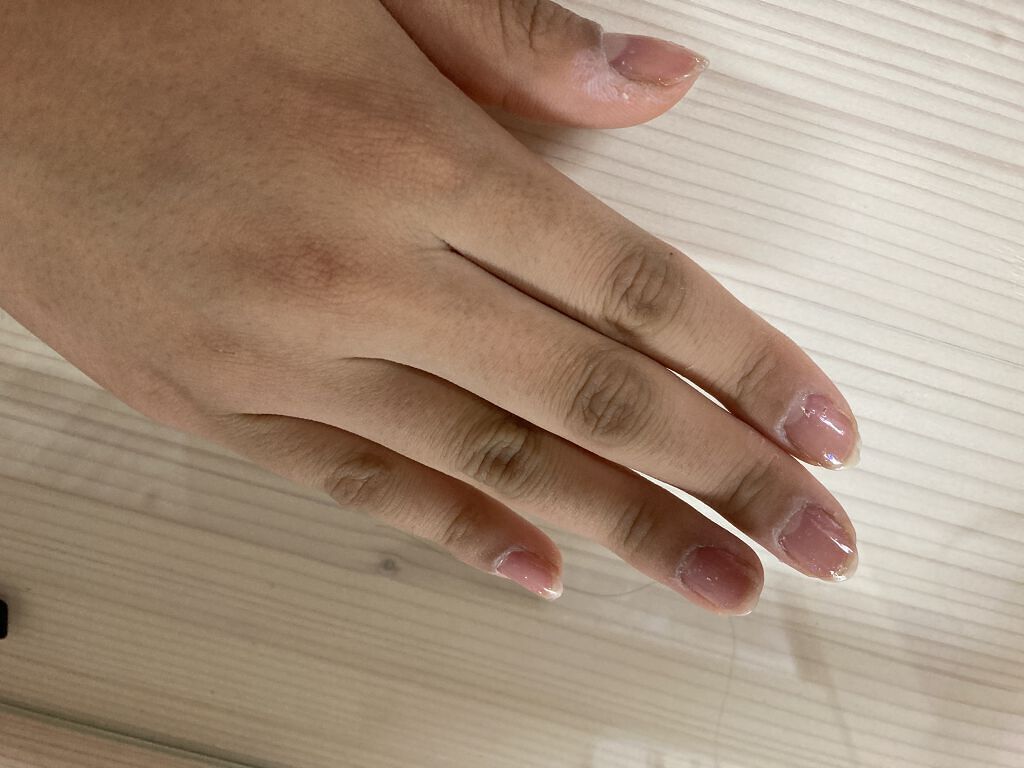 ケアノキュア（医薬品）/小林製薬/その他を使ったクチコミ（1枚目）