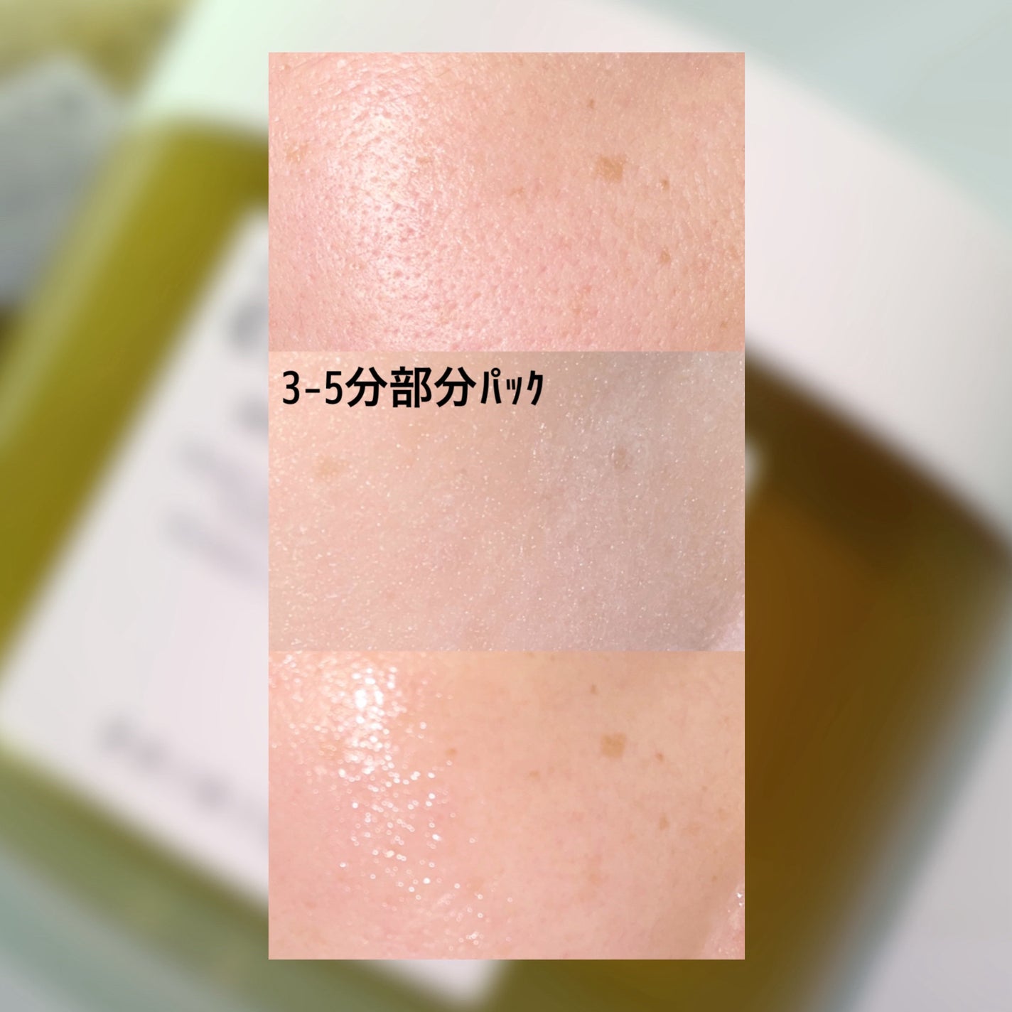 センテラ クイックカーミングパッド/SKIN1004/トナーパッドを使ったクチコミ(7枚目)