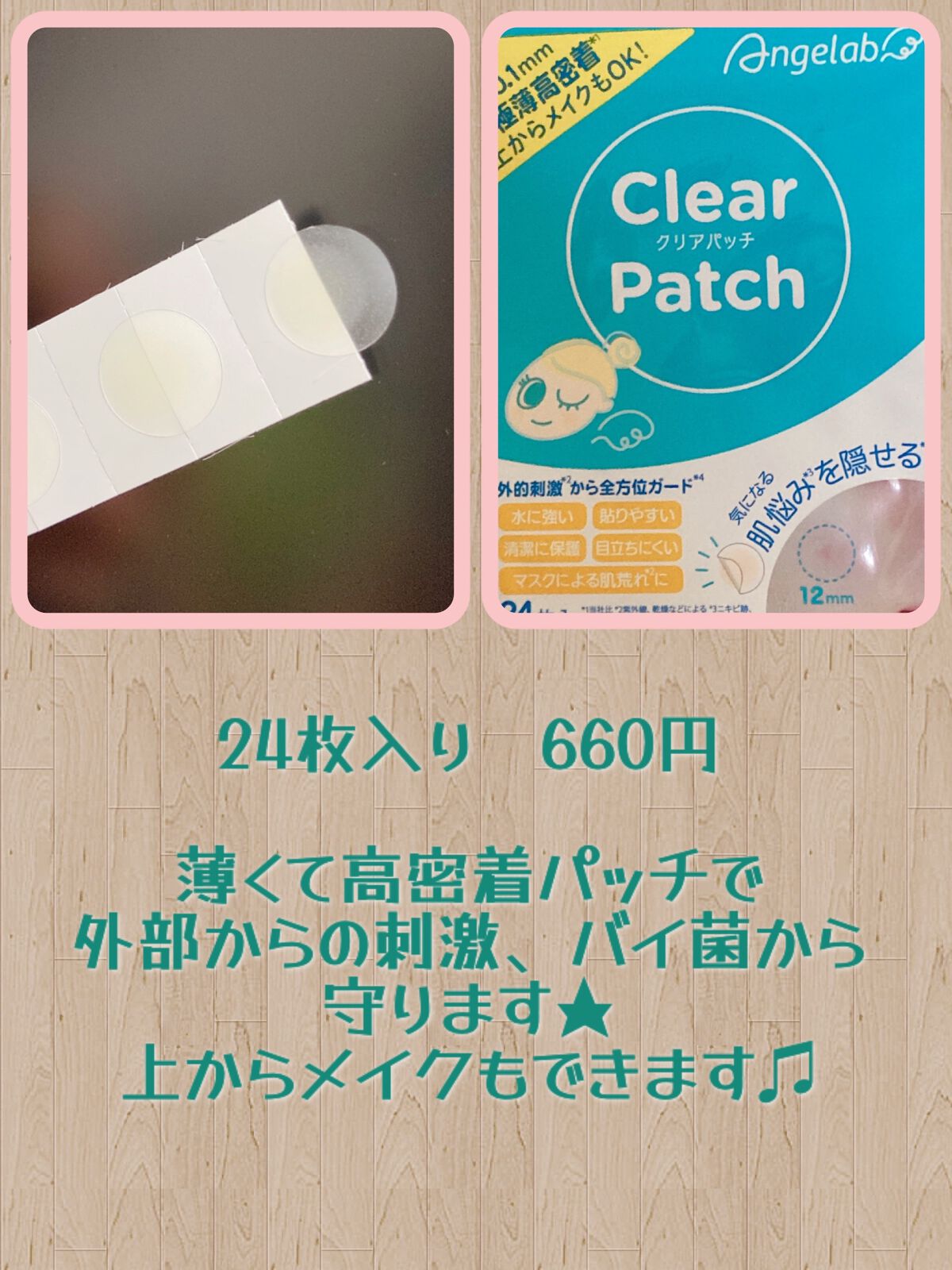AC SOLUTION CLEAR SPOT PATCH/G9SKIN/にきびパッチを使ったクチコミ（2枚目）