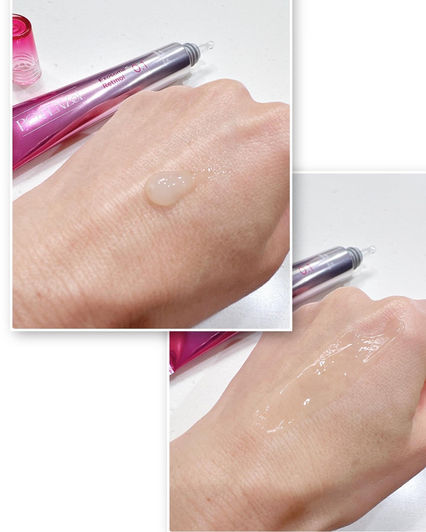 fuzukiフォロバ♡ on LIPS 「渡韓以来、すっかりハマってしまった肌管理。そんな美容医療"肌管..」(6枚目)