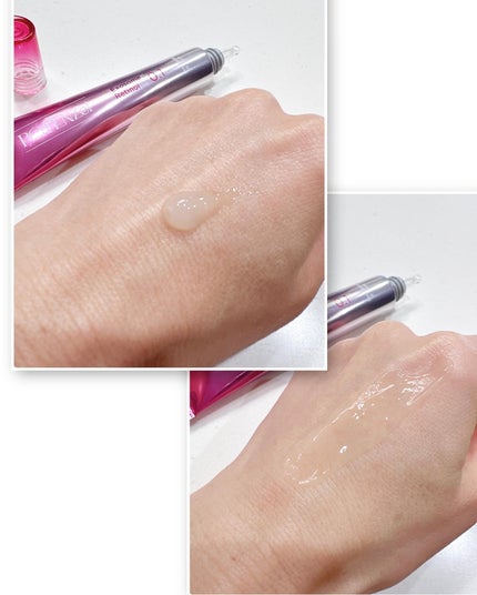 fuzukiフォロバ♡ on LIPS 「渡韓以来、すっかりハマってしまった肌管理。そんな美容医療"肌管..」(6枚目)