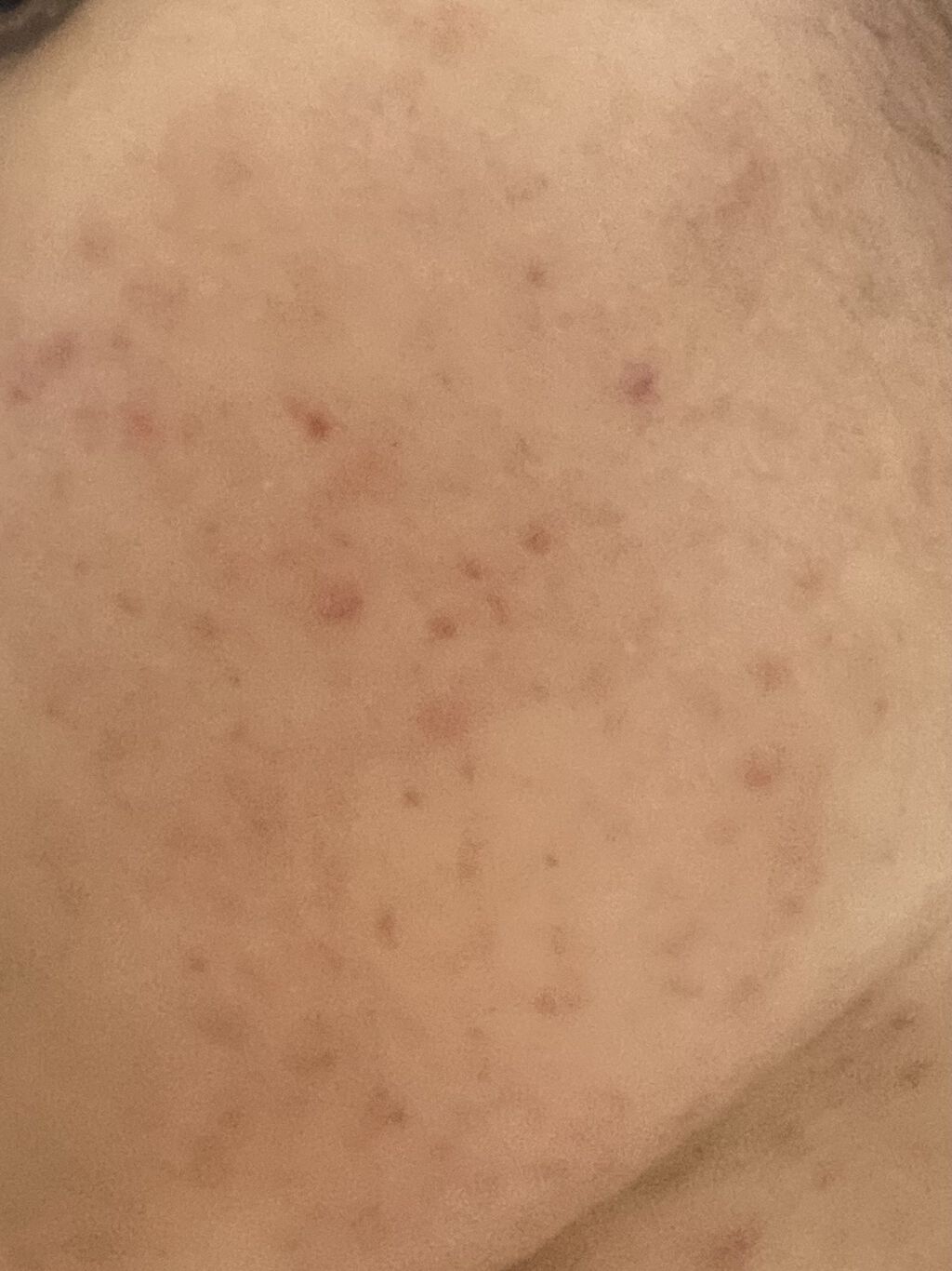 スチーマー ナノケア EH-SA35/Panasonic/美顔器・マッサージを使ったクチコミ（2枚目）