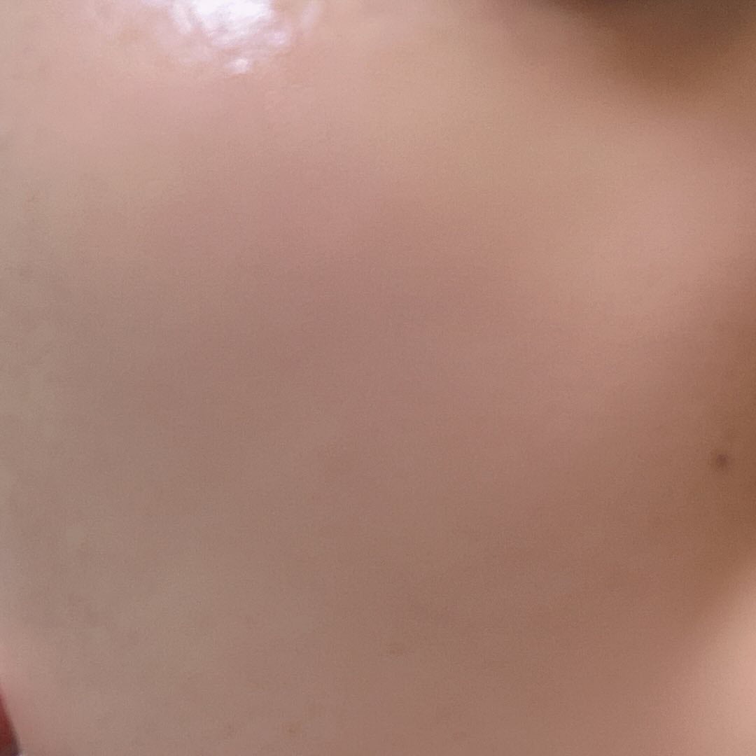 ヒアルサンアンプルデュオ ナイアシン5.0 アクアタイド4.0SET/ISCHIA/美容液を使ったクチコミ(5枚目)