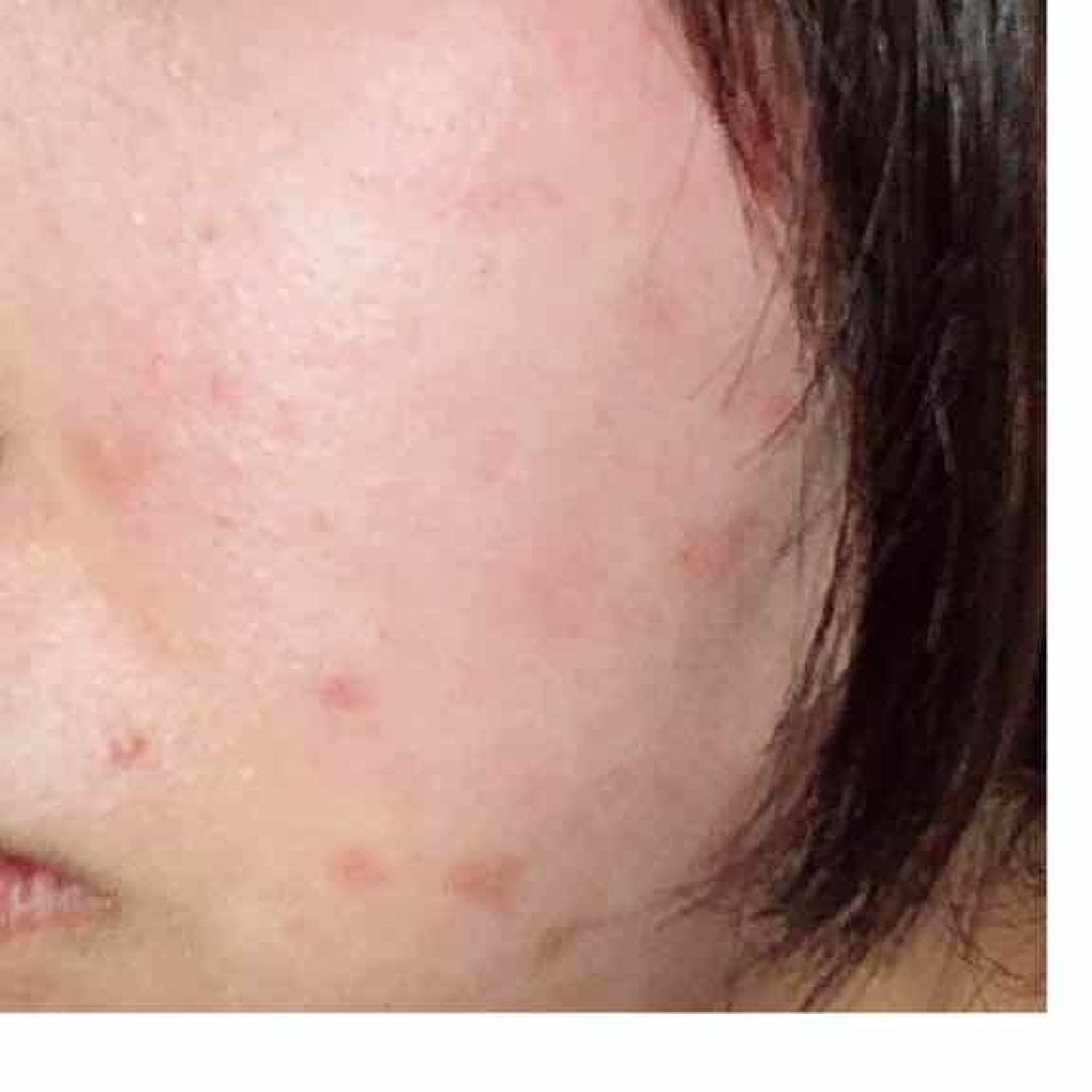 スポッツカバー ファウンデイション/SHISEIDO/クリームコンシーラーを使ったクチコミ（3枚目）