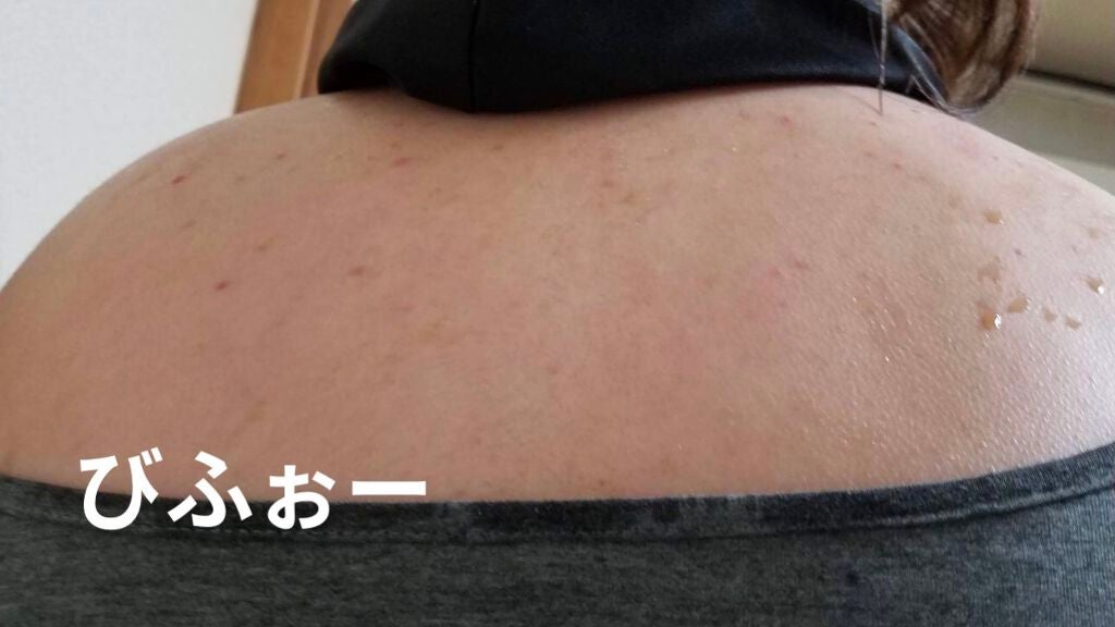 薬用パウダー化粧水/メンソレータム アクネス/化粧水を使ったクチコミ(5枚目)