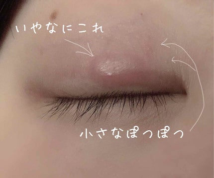アイビューティー フィクサー WP/アストレア ヴィルゴ/二重まぶた用アイテムを使ったクチコミ(2枚目)