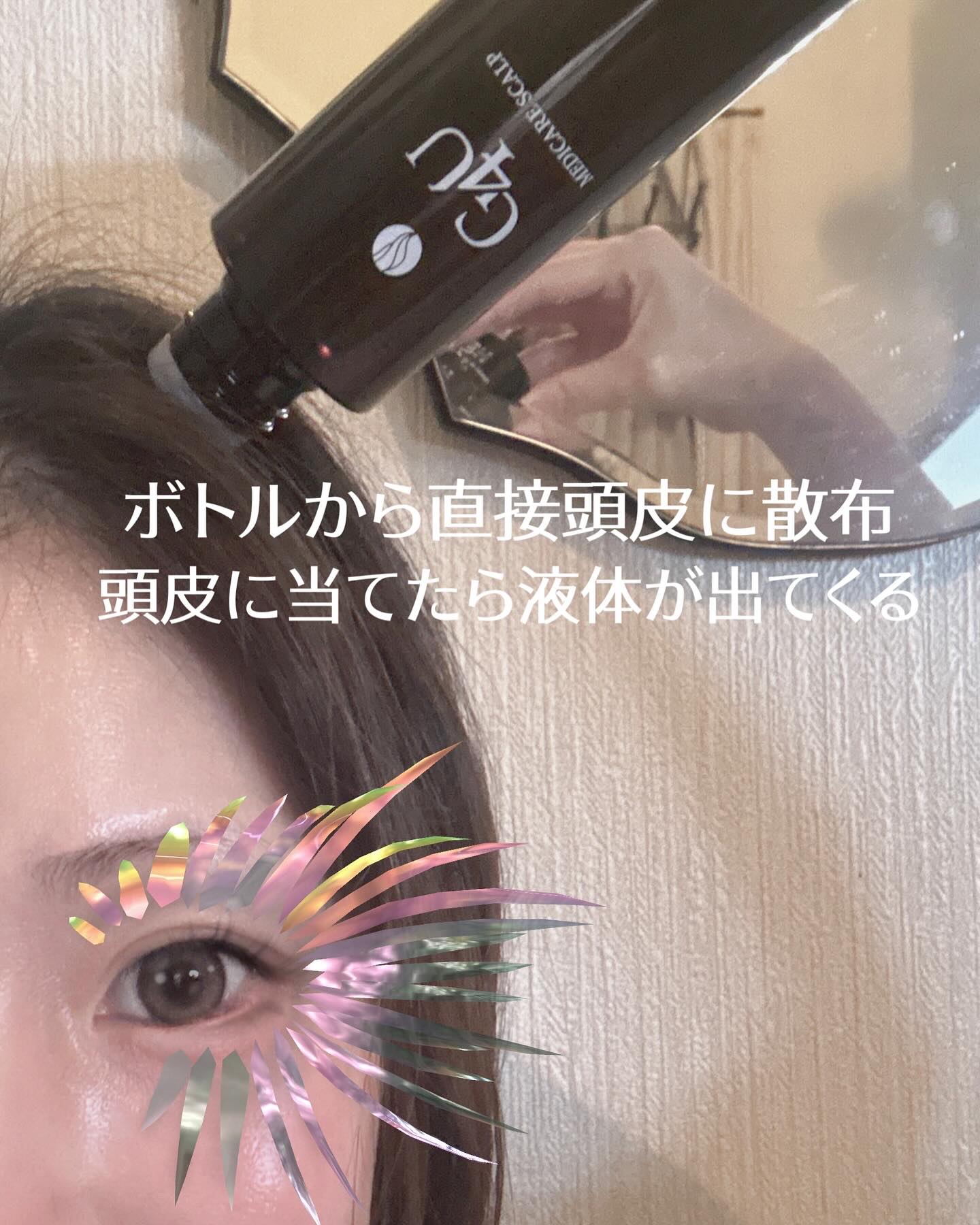 G4Uメディケアスカルプ/ZOGANKIN/頭皮ローションを使ったクチコミ（3枚目）